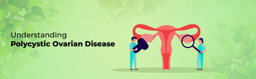 Understanding Polycystic Ovarian Disease