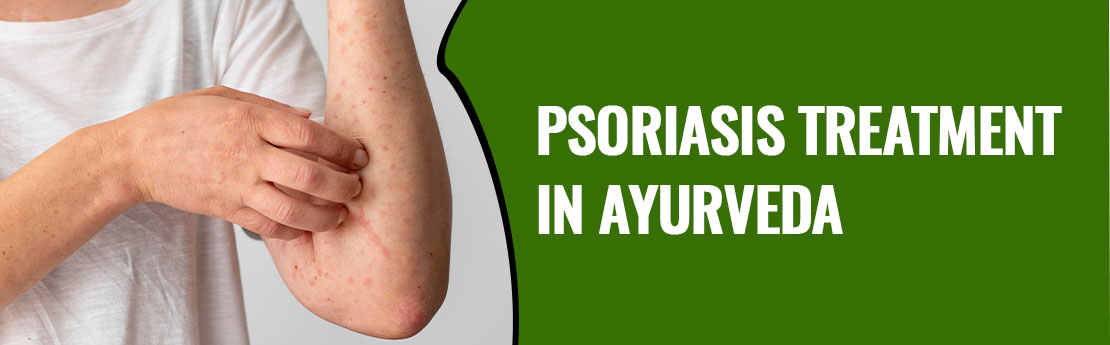 Ayurvedic psoriasis treatment